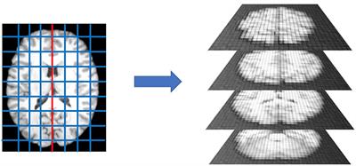 Deep Learning and Multiplex Networks for Accurate Modeling of Brain Age